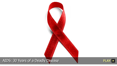 AIDS: 30 Years of a Deadly Disease AIDS: 30 Years of a Deadly Disease