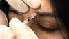 The Botox Cosmetic Treatment