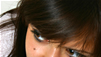 The Causes and Cures of Dandruff